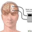 EEG PROCEDURES